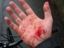 The Wound The Wound